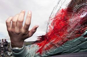 Gross Vehicular Manslaughter in Orange County Wallin & Klarich has successfully defended clients accused of gross vehicular manslaughter in Orange County for over thirty years.